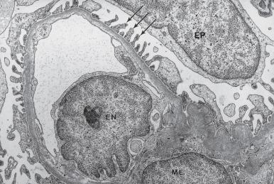 Figure 23.2, Electron Micrograph of Normal Glomerulus Showing the Relationship of Different Cell Types.