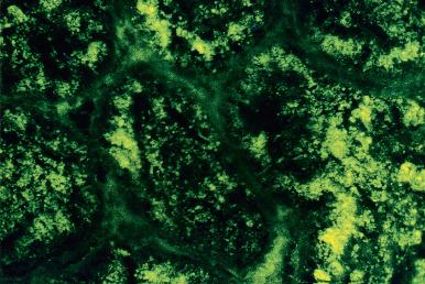 Figure 23.6, Immunofluorescence preparation demonstrating numerous albumin-positive resorption droplets in the proximal tubular epithelial cells.