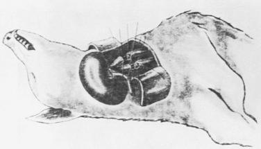 Fig. 1.4, Yu Yu Voronoy (1895–1961) had experience with dog allografts before carrying out the first human kidney allograft in 1933 at Kherson in the Ukraine. His experimental animal model is shown here.