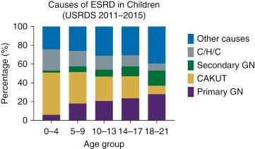 Fig. 37.1, Causes of end-stage renal disease (ESRD) in children stratified by age as reported by the US Renal Data System (USRDS) 2017 report. Primary glomerulonephritis (GN) diseases include focal glomerulosclerosis, membranous nephropathy, membranoproliferative GN, IgA nephropathy, and other proliferative GN. Congenital anomalies of the kidney and urologic tract (CAKUT) include congenital obstructive uropathy, renal hypoplasia/dysplasia, and reflux nephropathy. Secondary GN includes lupus nephritis, hemolytic uremic syndrome (HUS), Henoch-Schonlein (HSP), and vasculitis. Cystic, hereditary, and congenital (C/H/C) disorders include polycystic kidney diseases (dominant or recessive), Alport syndrome, congenital nephrotic syndrome, medullary cystic kidney diseases, including nephronophthisis, cystinosis, primary oxalosis, sickle cell disease, and other congenital malformation syndromes. Other causes include 7% of total patients in the reporting period with unknown etiology and 6.7% with missing data on etiology.