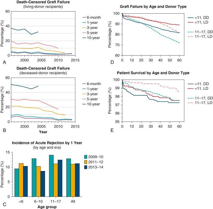 Fig. 37.3, Outcomes for pediatric kidney transplant recipients in the US as reported by the Scientific Registry of Transplant Recipients (SRTR) 2015 report. Death-censored graft survival for pediatric recipients of living donor (A) and deceased donor (B) kidney transplants. Graft failure (D) and patient survival (E) among pediatric recipients from 2006–2010 stratified by age and donor type. Incidence of acute rejection by 1 year for pediatric recipients over three eras, stratified by age group (in years) (C). DD , deceased donor; LD , living donor.