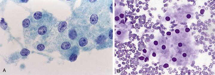 Fig. 15.2, Proximal Tubular Cells.