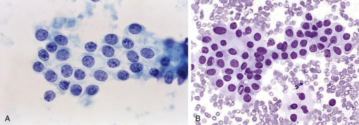 Fig. 15.3, Distal Tubular Cells.