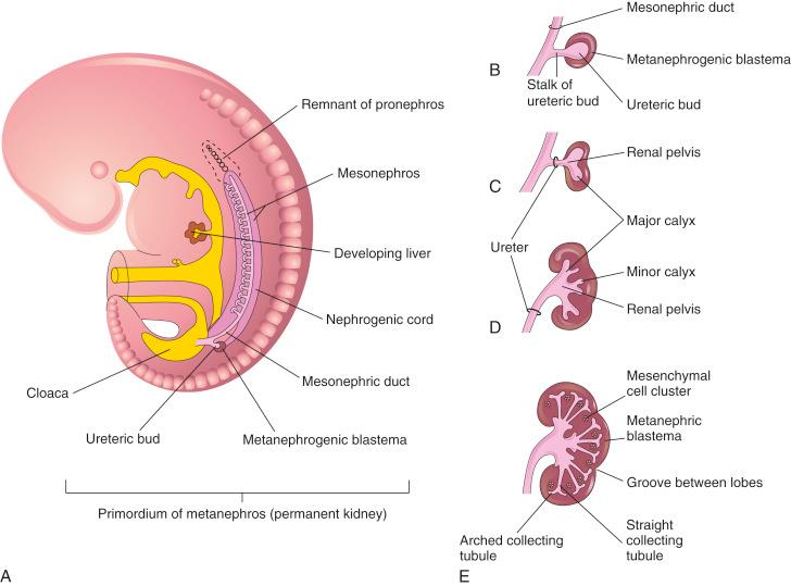 • Fig. 33.1, Embryonic development of the fetal kidney and urinary tract. A, Development of the metanephros at the end of the fifth week. B, The ureteric bud emerges from the caudally migrating mesonephric duct and interacts with the surrounding metanephrogenic blastema. C–E, Branching of the ureter and development of the ureter, renal pelvis, calices and collecting tubules.