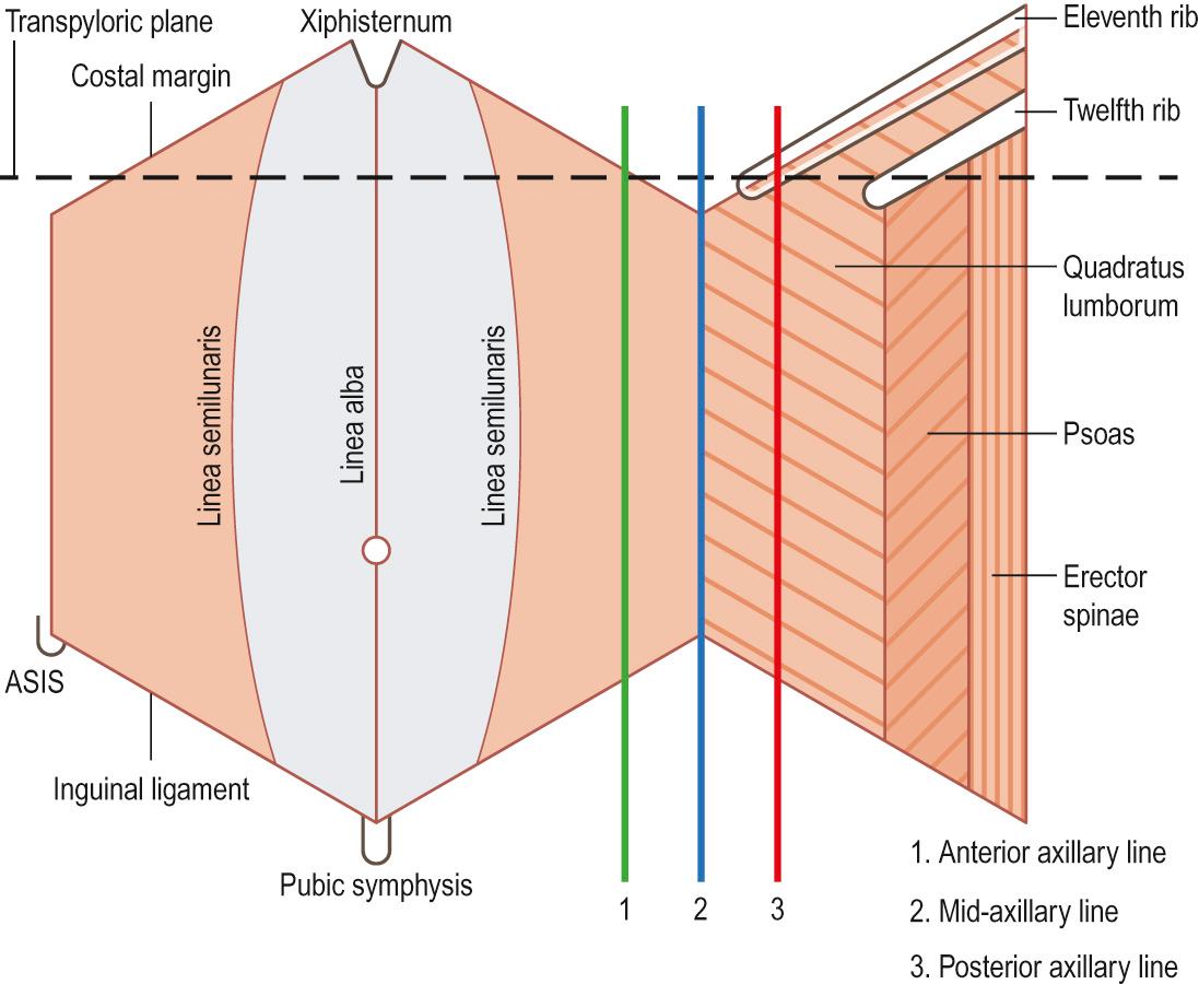 Fig. 69.1, Abdominal and flank surface markings (left side) demonstrating the boundaries of relevant areas and the inferred location of various organs, as well as access ports. Abbreviation: ASIS, anterior superior iliac spine.