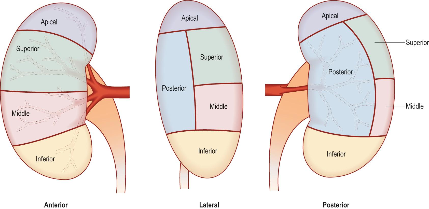 Fig. 69.3, The segmental arterial anatomy of the right kidney. The posterior division branches near the hilum before the anterior division divides into the other segmental arteries.