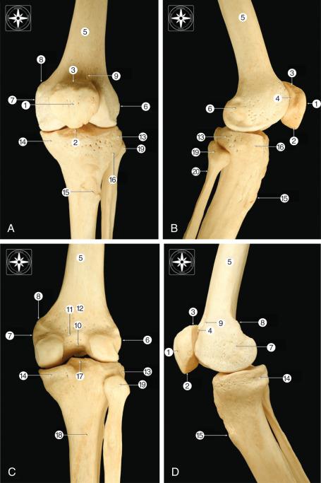 Fig. 89.2, Bony anatomy.