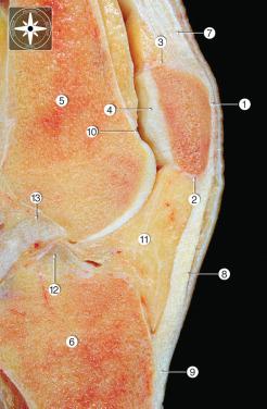 Fig. 89.5, Sagittal section of the knee joint.