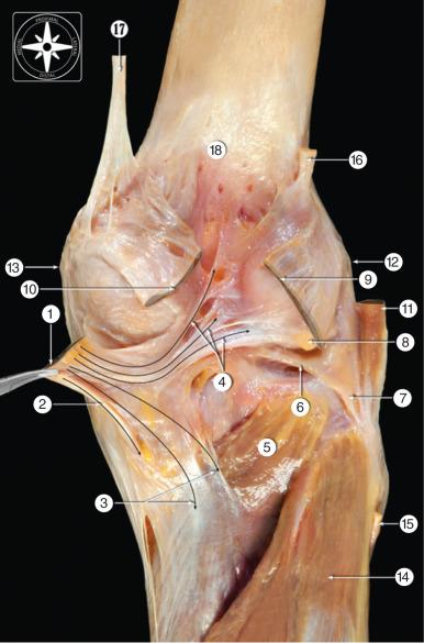 Fig. 89.7, Posterior view of the capsular structures of the knee joint.