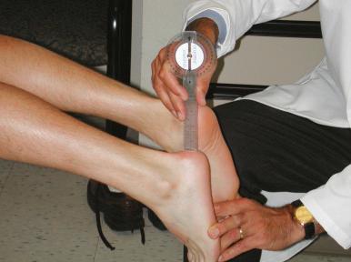 Fig. 90.9, The most sensitive way to measure extension deficit is to measure the heel-height distance difference with the patient in the prone position. A 1-cm difference roughly correlates with a 1-degree difference.