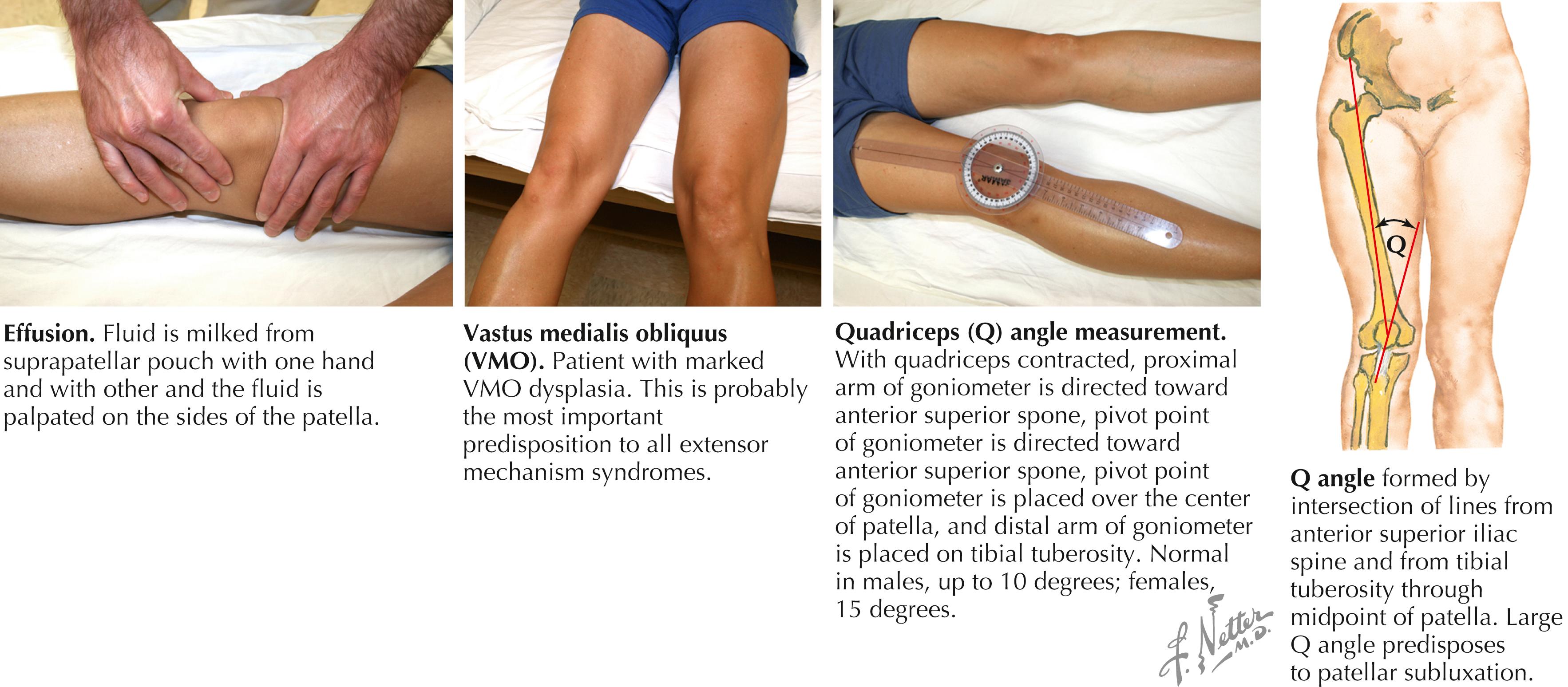 Figure 55.2, Observations and measurement of the knee.