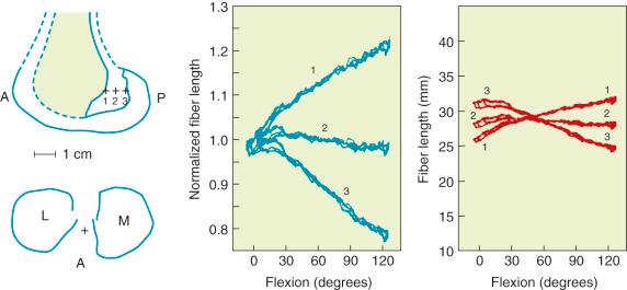 FIG 4-13, Sensitivity of fiber-length patterns to femoral attachment location in a cadaveric specimen. A, Anterior; L, lateral; M, medial; P, posterior.
