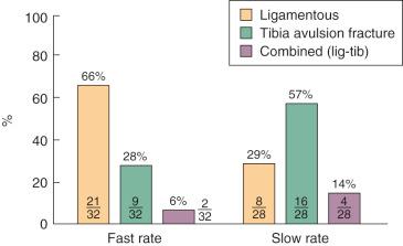 FIG 4-18, The major mechanism of specimen failure is shown for 32 knees tested at the fast strain rate and 28 knees tested at the slow strain rate. The difference in specimen failure at the two strain rates is statistically significant ( P < .05).