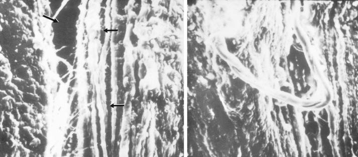 FIG 4-7, Scanning electron microphotographs of an anterior cruciate ligament after it was loaded to one half its anticipated maximum load without evidence of failure. Microfailure occurs. A whole fiber bundle completely ruptured is shown at left ( arrows ). Separation of fibers within a bundle is shown at right.