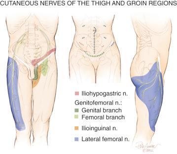 FIG 39-4, Skin territory innervated by different nerves related to the groin. The lateral femoral cutaneous nerve territory is shown in blue and extends distally to the knee. Compression or stretch/traction injury of this nerve can be perceived as knee pain.