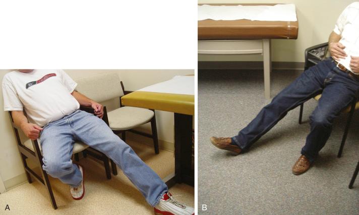 FIG 39-7, Clinical sign of compression of the lateral femoral cutaneous nerve (meralgia paresthetica). Two examples are shown. The patient can be observed to be sitting with the lower extremity on the painful side extended at the hip. Hip flexion increases pressure on the lateral femoral cutaneous nerve as it exits through the site of compression. Shown are a left ( A ) and a right ( B ) lateral femoral cutaneous nerve compression.