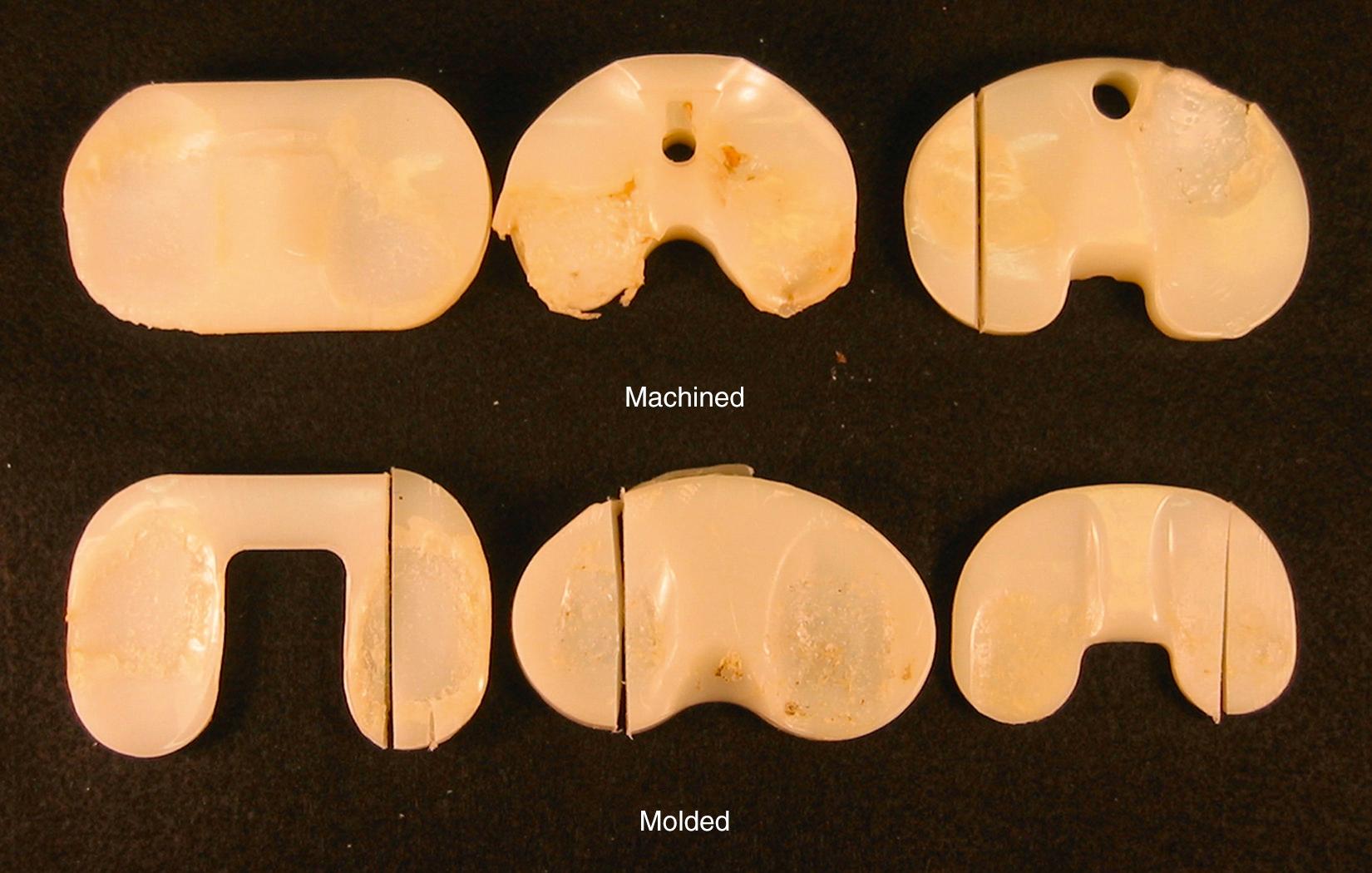 FIG 24.2, Fatigue failure occurs in most types of gamma-sterilized tibial inserts, regardless of design, material, or method of fabrication—machined (top row) or molded (bottom row).