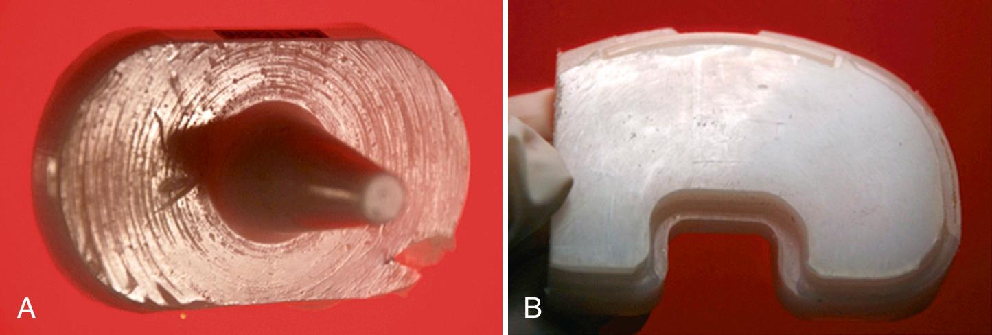 FIG 24.6, With knee wear, appearances can be deceiving, as evidenced by this pair of retrievals. (A) A scratched and pitted LCS insert in vivo 12.8 years, with measured backside wear of 267 mm 3 . (B) A much smoother, less damaged appearance of a PFC insert in vivo 11.8 years, with estimated backside wear of 1742 mm 3 .