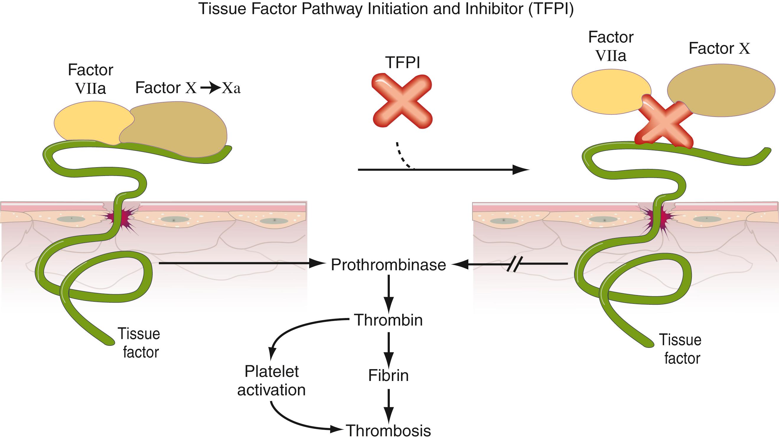 Figure 42.1, Tissue factor pathway initiation and inhibitor mechanisms. TFPI, Tissue factor pathway inhibitor.