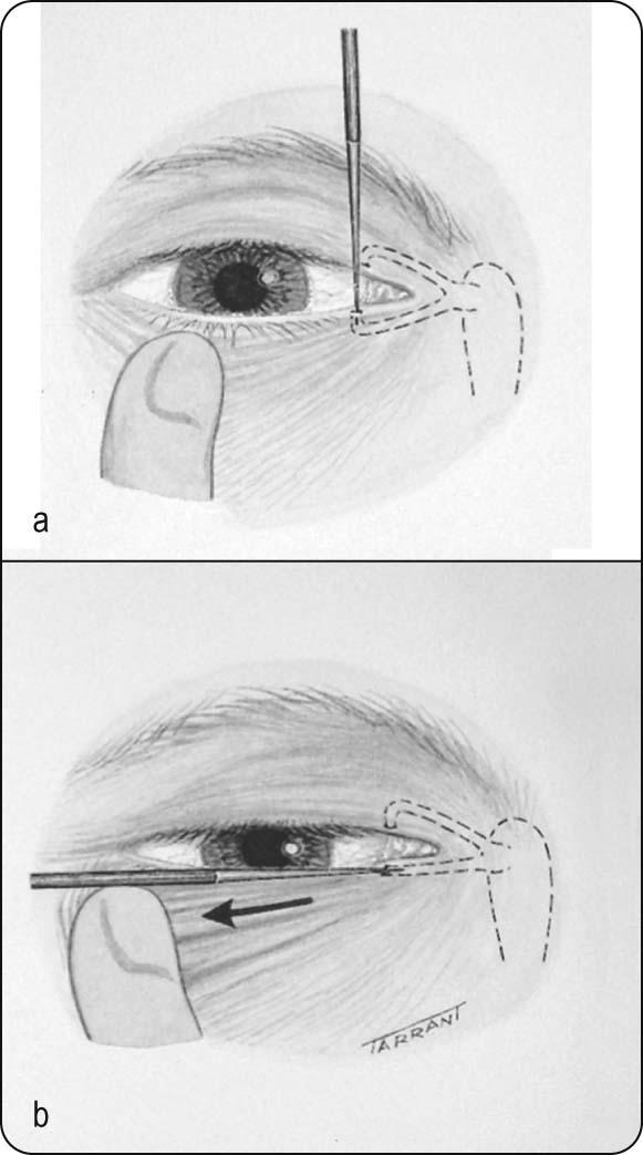 Fig 2.1