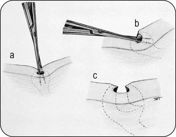 Fig 2.2