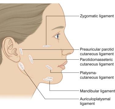 FIGURE 38.1, Facial retaining ligaments. All of these ligaments bind the dermis to the SMAS. The zygomatic and mandibular ligaments also provide firm attachments between SMAS and bone. The parotidomasseteric ligaments also attach SMAS to the deeper masseteric fascia. Skin mobility is increased if the dermal attachments of these ligaments are partially or completely severed during rhytidectomy. SMAS mobility is increased if the zygomatic and parotidomasseteric ligaments are released deep to the SMAS.