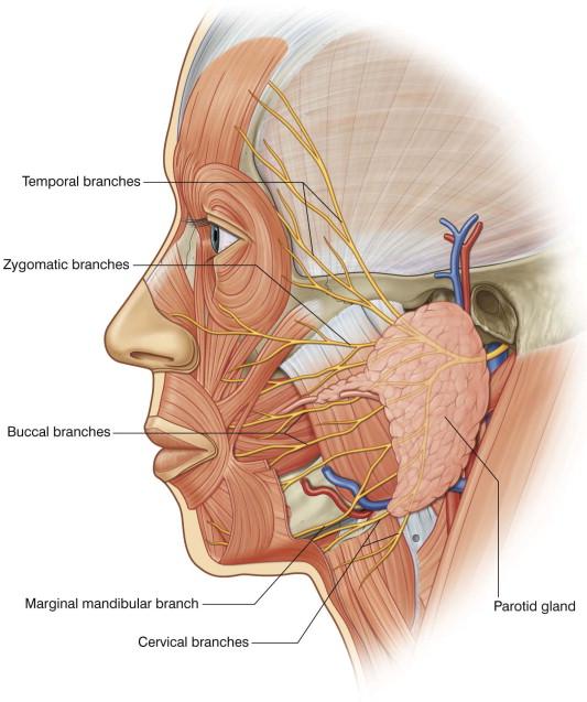 FIGURE 38.2, Branches of the facial nerve. Caudal to the zygomatic arch, all facial nerve branches lie beneath the parotid gland and SMAS and are protected from injury if undermining is done superficial to these structures. If sub-SMAS undermining is performed, the zygomatic and buccal branches are vulnerable to injury. Superficial to the zygomatic arch and in the temple region, the temporal branches run within the superficial temporal fascia.