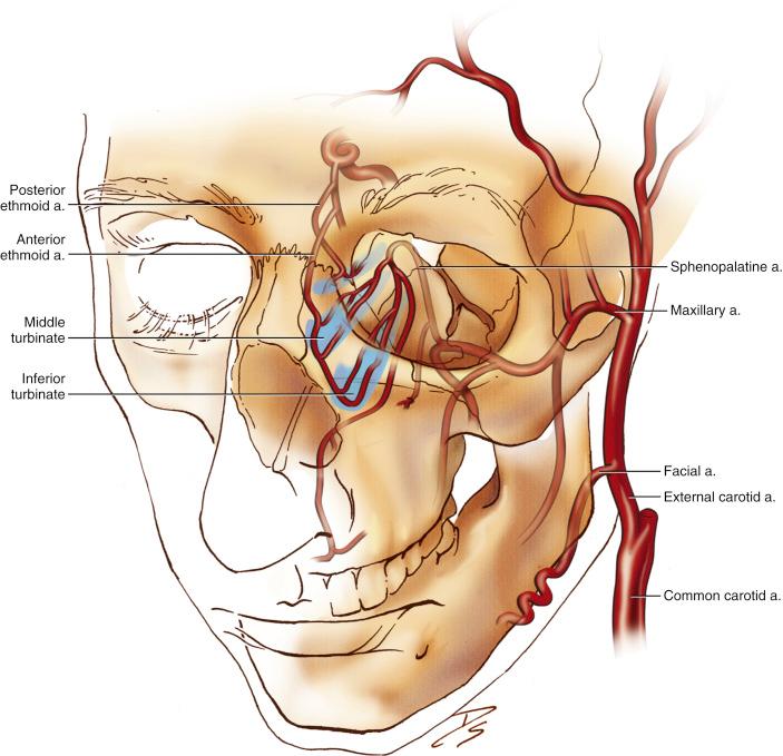 Fig. 31.2, Nasal flap vasculature showing the major arterial supplies involved in vascularized flaps.