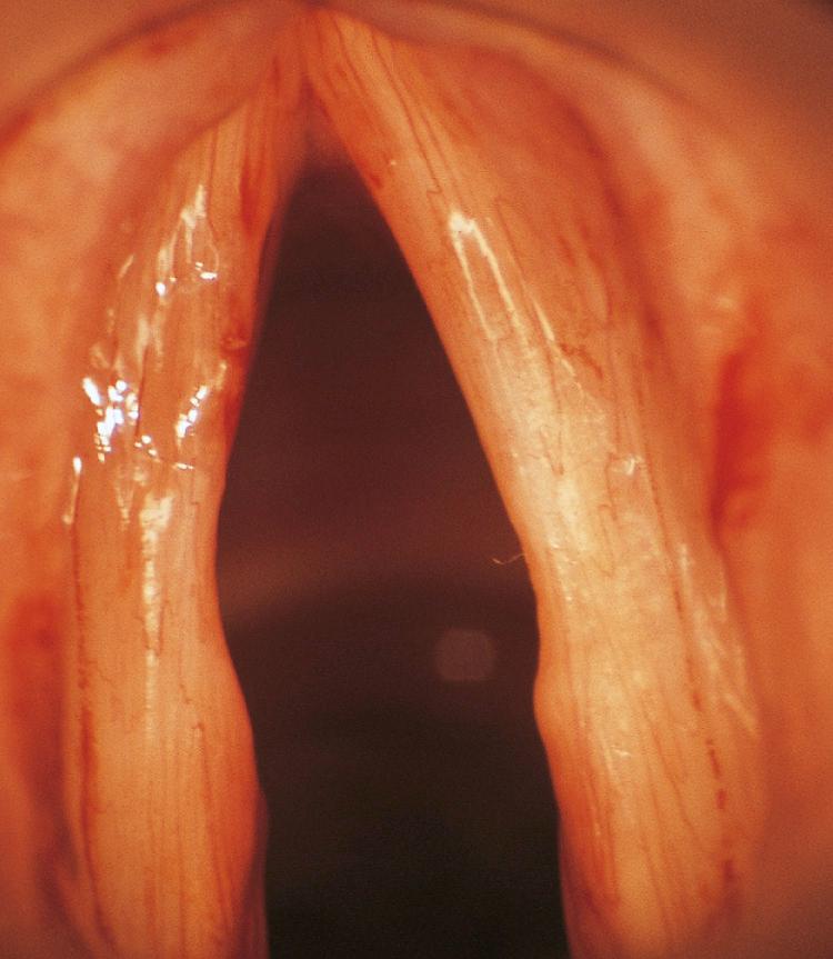 Figure 10.59, The surgical defect.