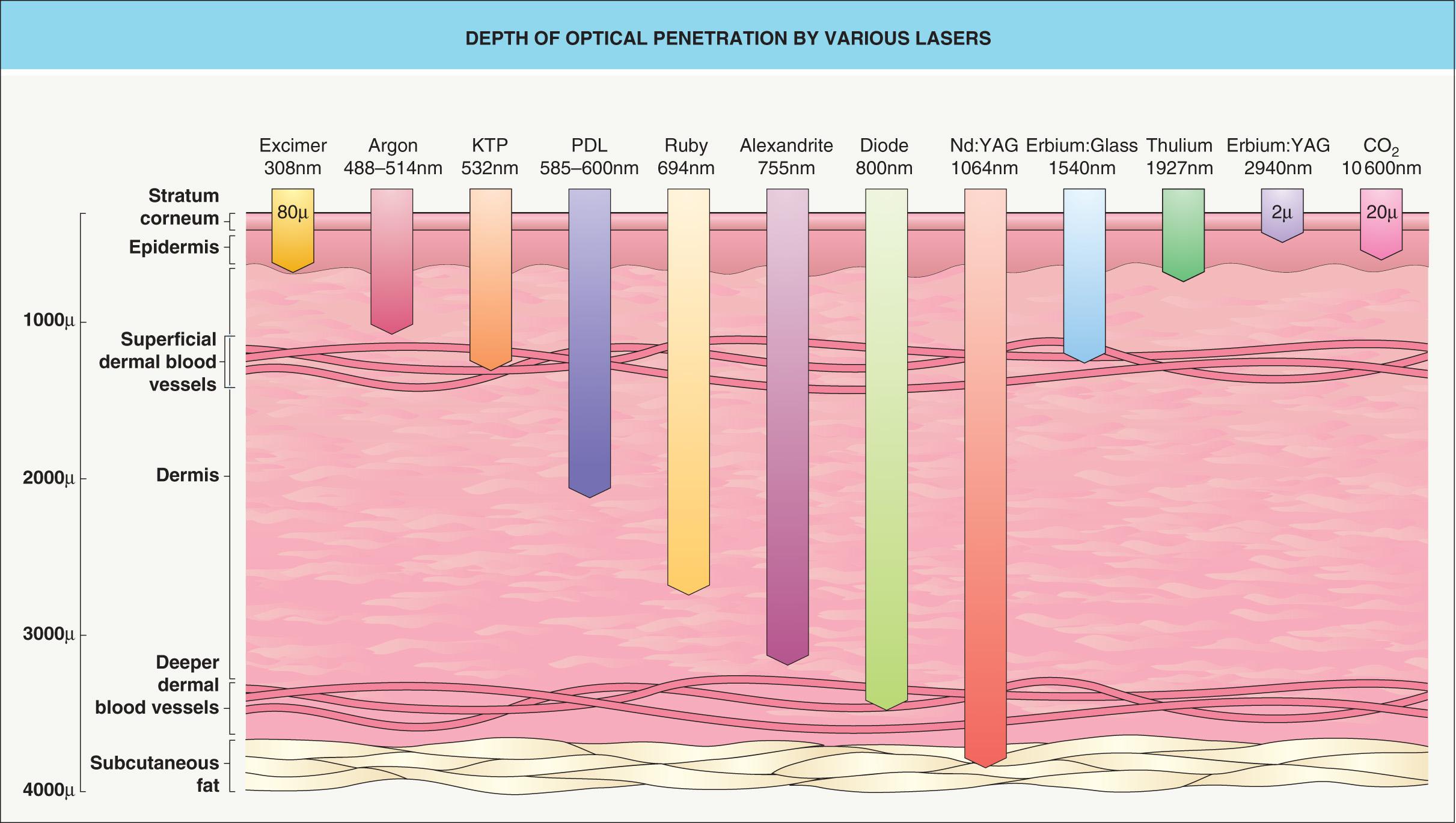 Fig. 136.5, Depth of optical penetration by various lasers.