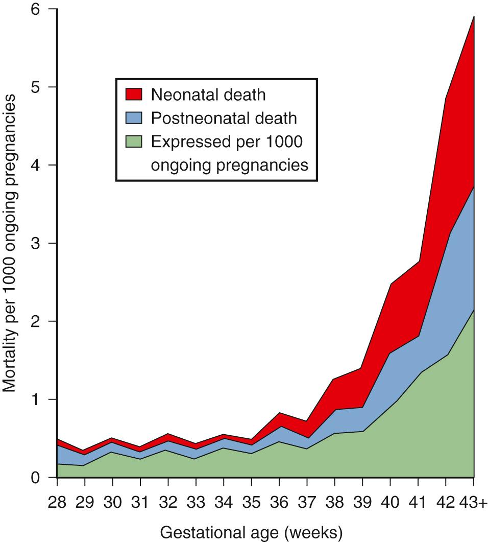 Fig. 29.1, Summed Mortality at Each Gestation for the Rate of Stillbirth (Red) , Neonatal Death (Blue) , and Postneonatal Death (Green) Expressed per 1000 Ongoing Pregnancies.