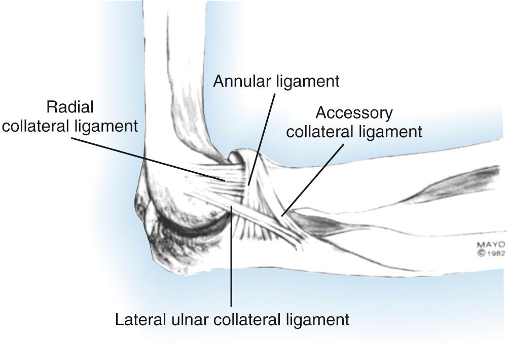 FIG 71.1, From a practical perspective, the lateral collateral ligament complex may be divided into three main components: the lateral ulnar collateral ligament, the annular ligament, and the radial collateral ligament.