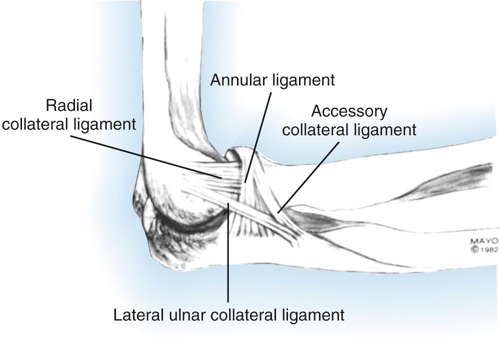 Lateral Collateral Ligament Insufficiency - Clinical Tree