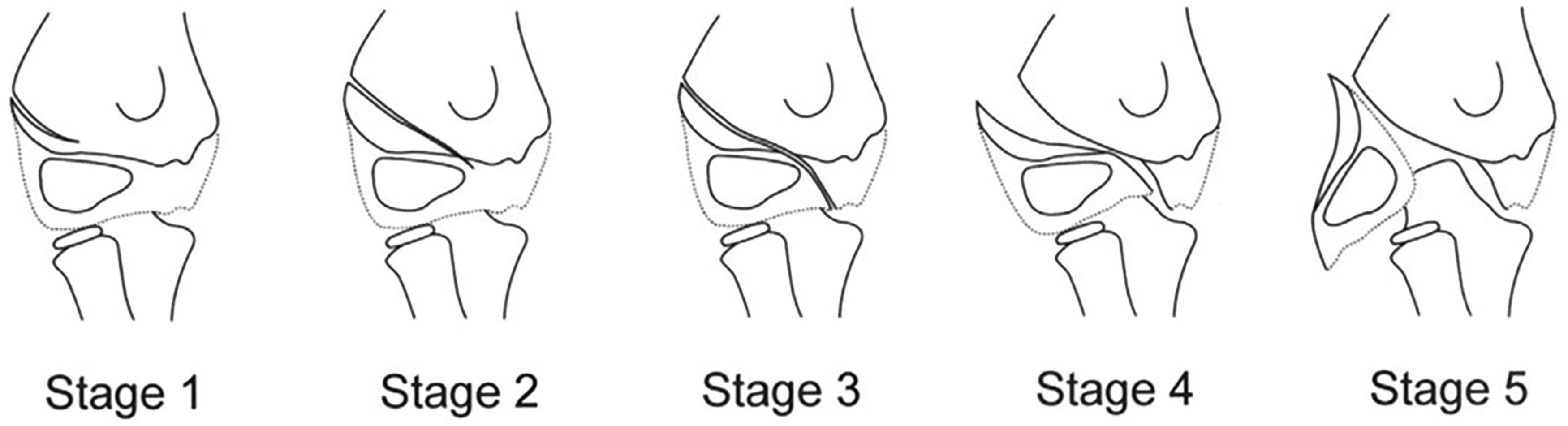 Fig. 3.1, Song Classification.