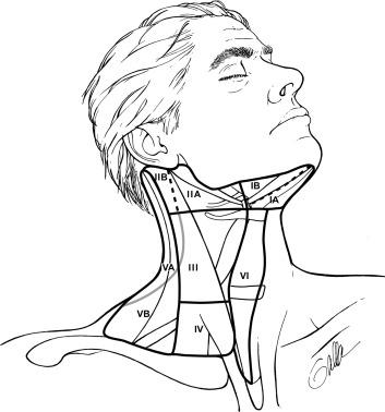 Fig. 39.1, Neck dissection levels.