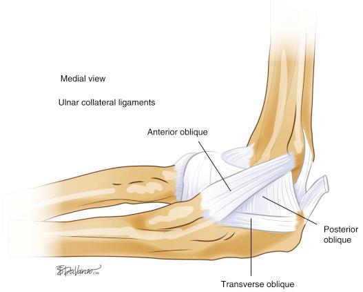 Lateral: Posterolateral Rotary Instability - Clinical Tree