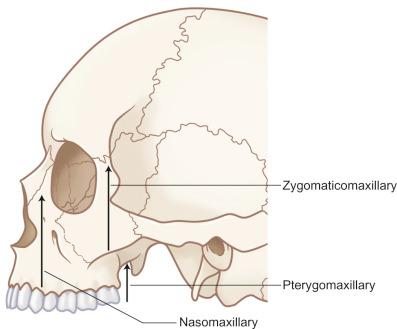 Fig. 1.13.1, Sagittal view of the vertical buttresses of the face.