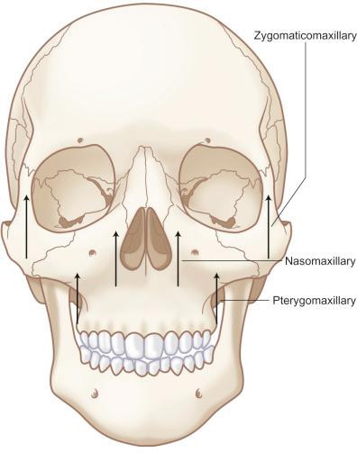 Fig. 1.13.2, Anterior view of the vertical buttresses of the face.