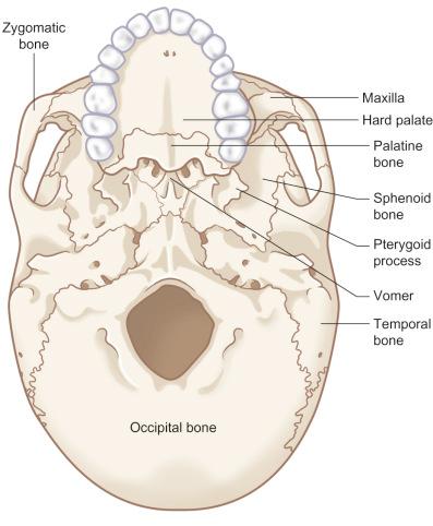 Fig. 1.13.4, Inferior view of the skull – skeletal anatomy.