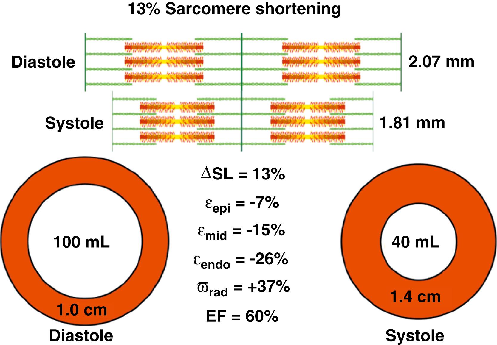 Figure 23.1, Schematic representation of sarcomere shortening (optimally near 13%) and the circumferential and radial deformation necessary to ejection 60% of the cavity volume. A simple circumferential wrapping of fibers would lead to incomplete sarcomeric shortening in the epicardium and a crumpling of myofibrils in the subendocardium. ΔSL, Change in sarcomere length; ε, regional strain, with the subscripts epi, mid, and endo referring to circumferential shortening at these respective myocardial levels and rad referring to radial thickening; EF, ejection fraction.