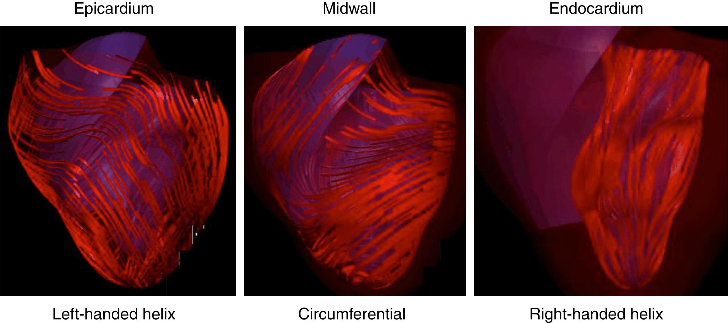 Figure 23.2, Myofibril orientation in the epicardium, mid-wall, and endocardium.