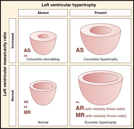 Fig. 5.7, LV Hypertrophic Remodeling.