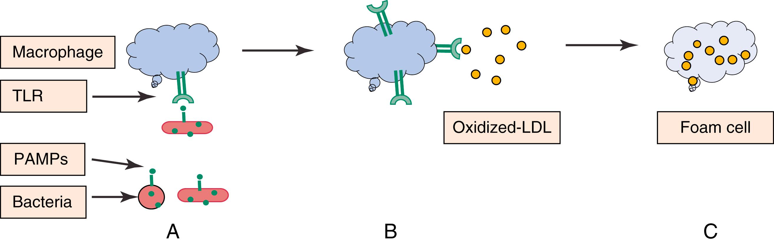 Figure 16.3, Potential Mechanism of Atherosclerosis Formation by Infectious Pathogens.