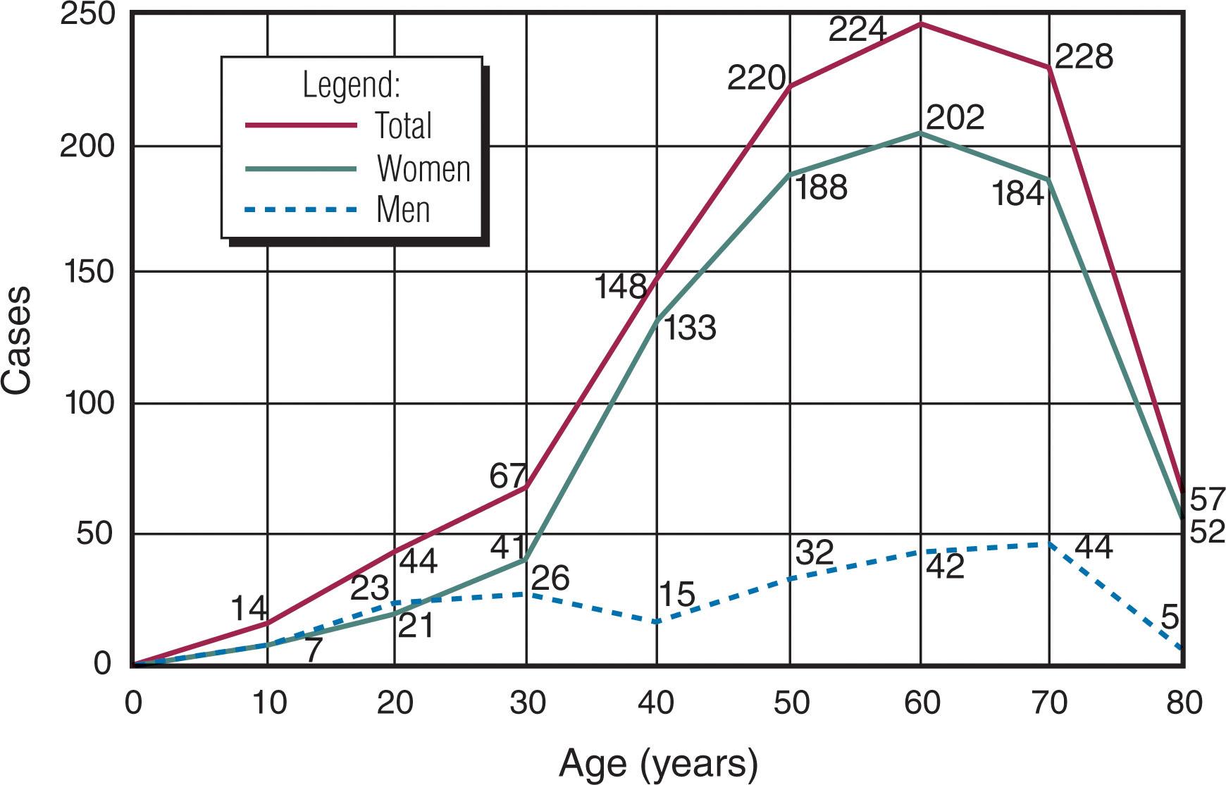 Fig. 9-6, Hammer toe deformities peak during the fifth, sixth, and seventh decades in the female population. In the male population, there is no increase in the frequency of hammer toe deformities with increasing age.