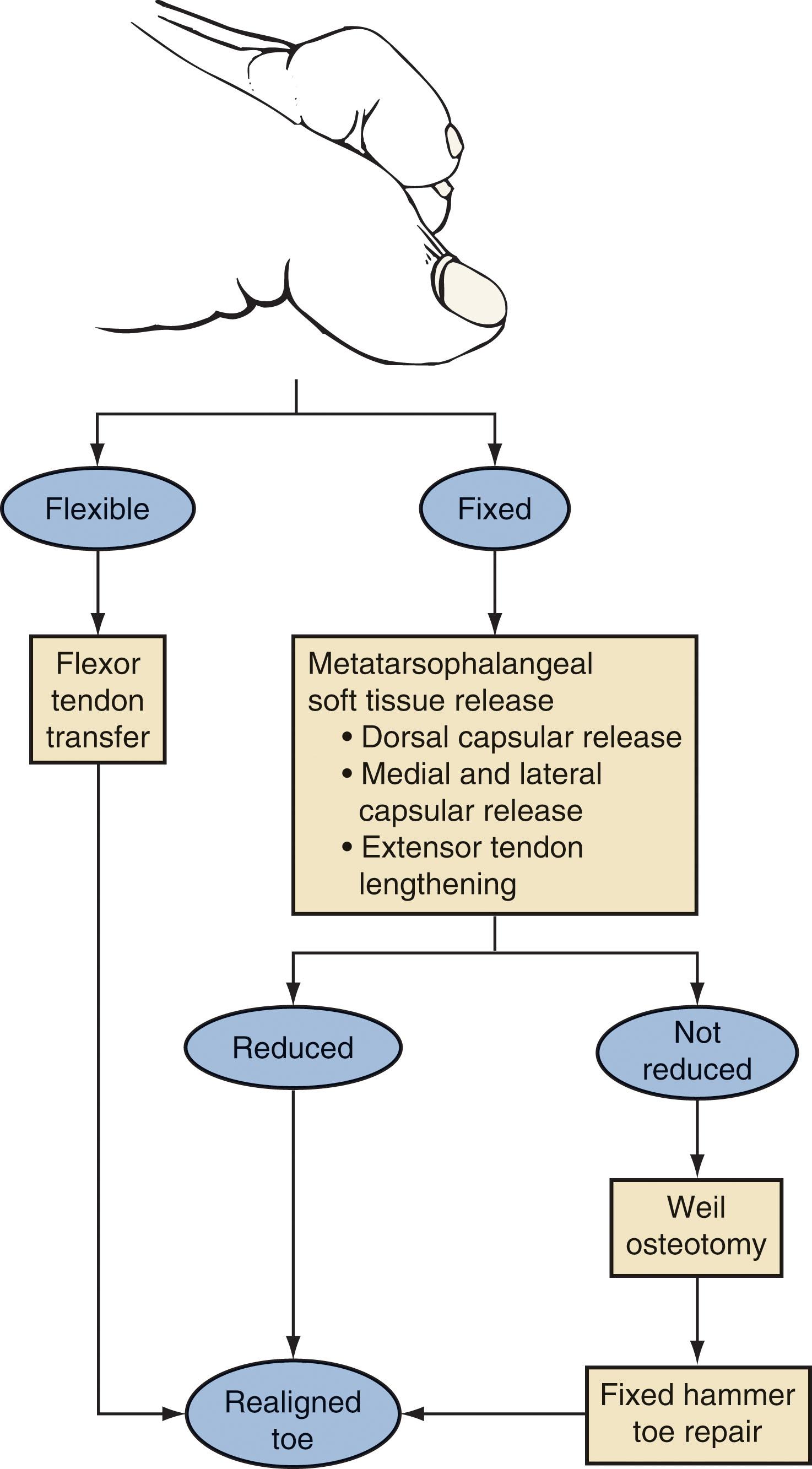 Fig. 9-74, Algorithm for treatment of claw toe.