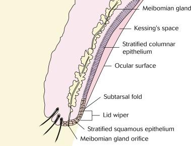 Fig. 5.1, Relationship of areas of contact and non-contact between the upper eyelid and ocular surface. The area of the lid wiper starts posterior to the meibomian glands, where the stratified conjunctival epithelium changes from keratinised to non-keratinised tissue and extends superiorly to the subtarsal fold.