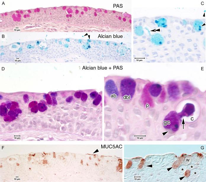 Fig. 5.3, Overview of a lid wiper shows several goblet cells, some of them arranged in groups at the surface and others deep in the epithelium. Goblet cells are stained in serial sections either by Periodic Acid–Schiff (PAS) (A) and Alcian blue (B, C) or by combined staining (D, E) . One isolated goblet cell deep inside the epithelium ( C , Alcian blue) shows a narrow stained extension (double arrowhead) of the cytoplasmic content that points to the surface and conceivably indicates the delivery of mucus into a cryptal lumen or directly toward the surface. Staining with Alcian blue plus periodic acid–Schiff (D, E) shows that most goblet cells are double stained (dbl in E ) and have an intermediate color. (E) Some goblet cells stain preferably for either Alcian blue (ab) or periodic acid–Schiff (p). Stained mucus material from a goblet cell (gc) with basal flat nucleus (arrowhead) deep in the epithelium of the lid wiper is seen to be continuous (arrow) with mucus in a cryptal lumen (c), suggesting delivery of mucus into a luminal space. Immunohistochemistry for MUC5AC (F, G) revealed that some goblet cells are strongly positive for MUC5AC ( arrowheads in G ), whereas others are weakly stained (w) and yet others are negative (asterisks) . In places, MUC5AC-positive material is seen deposited on the epithelial surface ( F , arrowhead ). Note that Alcian blue shows artificial stain concrements ( B, C , small arrowheads ) on the section and on the glass slide. Paraffin histology: (A) periodic acid–Schiff; (B, C) Alcian blue; (D, E) Alcian blue plus periodic acid–Schiff; (F, G) MUC5AC. Size marker in A–G = 10 μm.