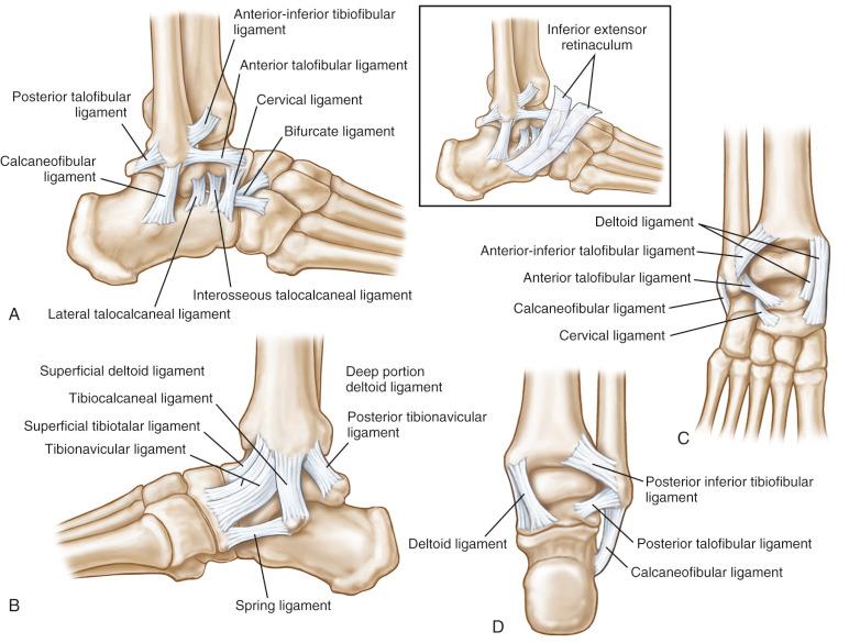 Fig. 117.1, Compendium of the foot and ankle ligaments. (A) The lateral view of the foot and ankle demonstrating the anterior talofibular ligament, calcaneofibular ligament, posterior talofibular ligament, anterior-inferior tibiofibular ligament, lateral talocalcaneal ligament, inferior extensor retinaculum, interosseous talocalcaneal ligament, cervical ligament, and bifurcate ligament. (B) The medial view of the foot and ankle demonstrating the superficial deltoid ligament, including the tibionavicular, spring ligament, tibiocalcaneal, and superficial tibiotalar components. (C) The anterior view of the ankle and hindfoot demonstrating the deltoid ligament with its superficial and deep components, the anterior-inferior tibiofibular ligament, the cervical ligament, the anterior talofibular ligament, and the calcaneofibular ligament. (D) The posterior view of the ankle and hindfoot demonstrating the deltoid ligament with its superficial and deep components, the posterior-inferior tibiofibular ligament, the posterior talofibular ligament, and the calcaneofibular ligament.