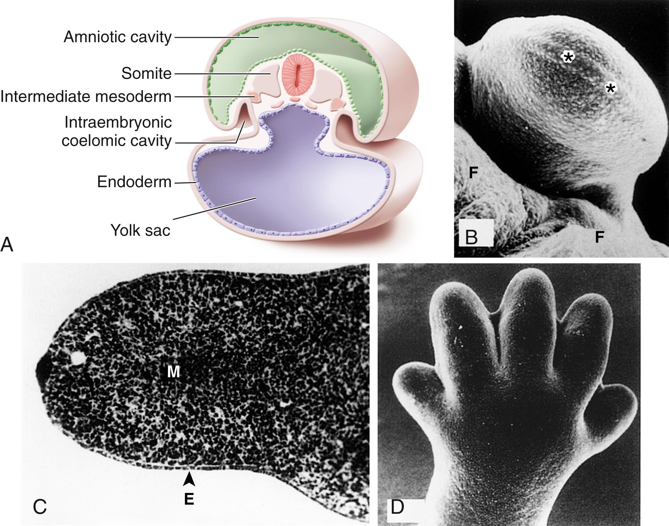 Fig. 21.2, Limb development. (A) Cross section through an embryo. The intermediate mesoderm signals the lateral plate mesoderm to initiate limb development. (B) The early limb bud. Asterisks indicate the location of the apical ectodermal ridge (AER), which regulates proximodistal growth of the limb bud. F, Flank. (C) Longitudinal section of the limb bud showing the ectoderm (E) surrounding a core of undifferentiated mesoderm (M) . (D) Digits are forming following programmed cell death in the AER in the spaces between the digits. Each digit then continues to grow under the influence of its own AER. More tissue between the digits will be removed by programmed cell death.