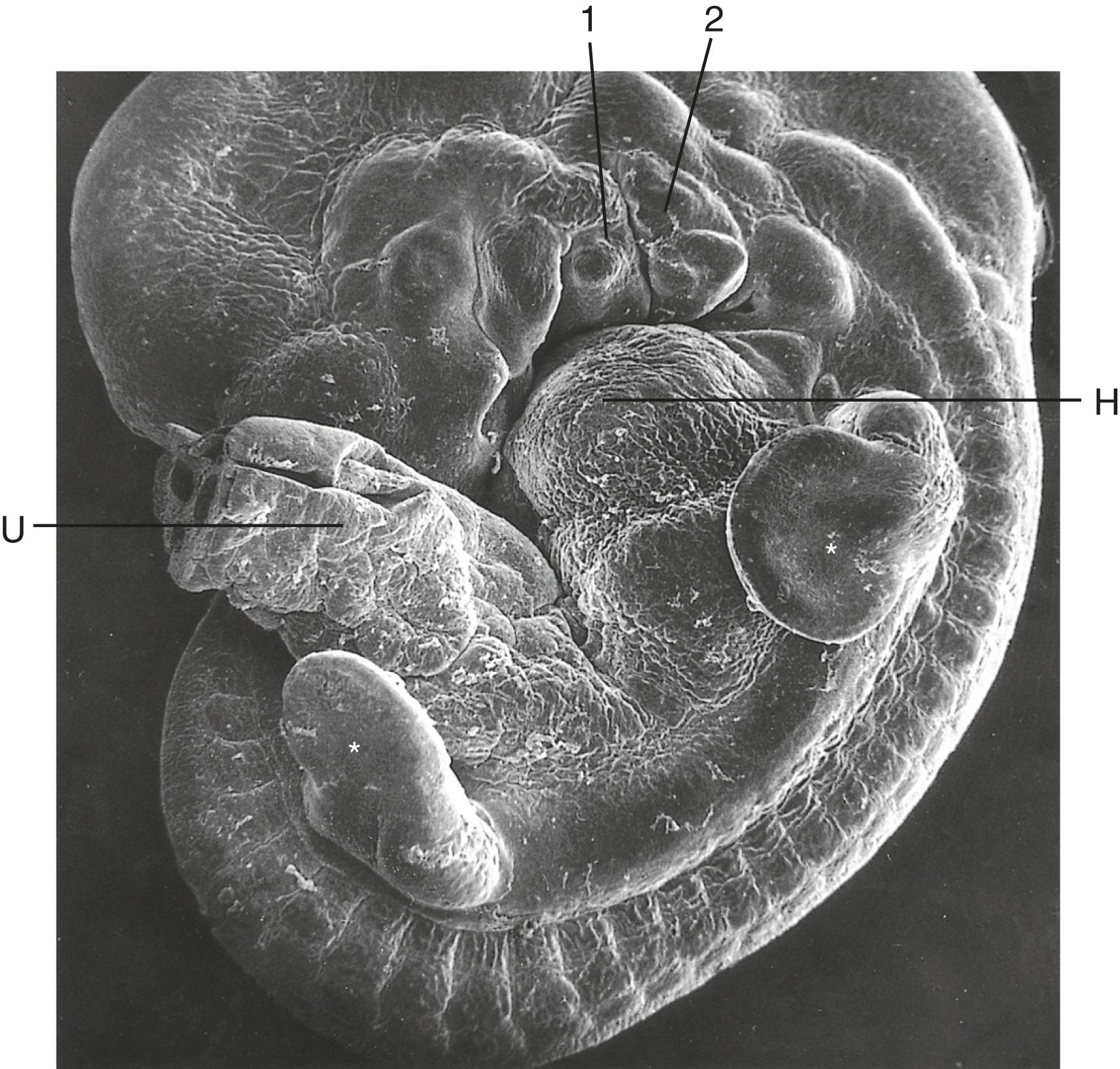 Fig. 10.7, Scanning electron micrograph of a 5-week human embryo (10 mm).